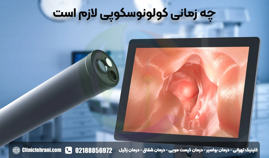 چه زمانی کولونوسکوپی لازم است