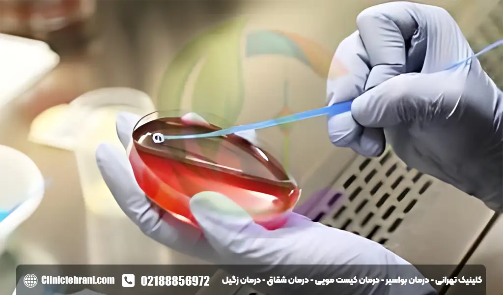 عکس ادرار خونی