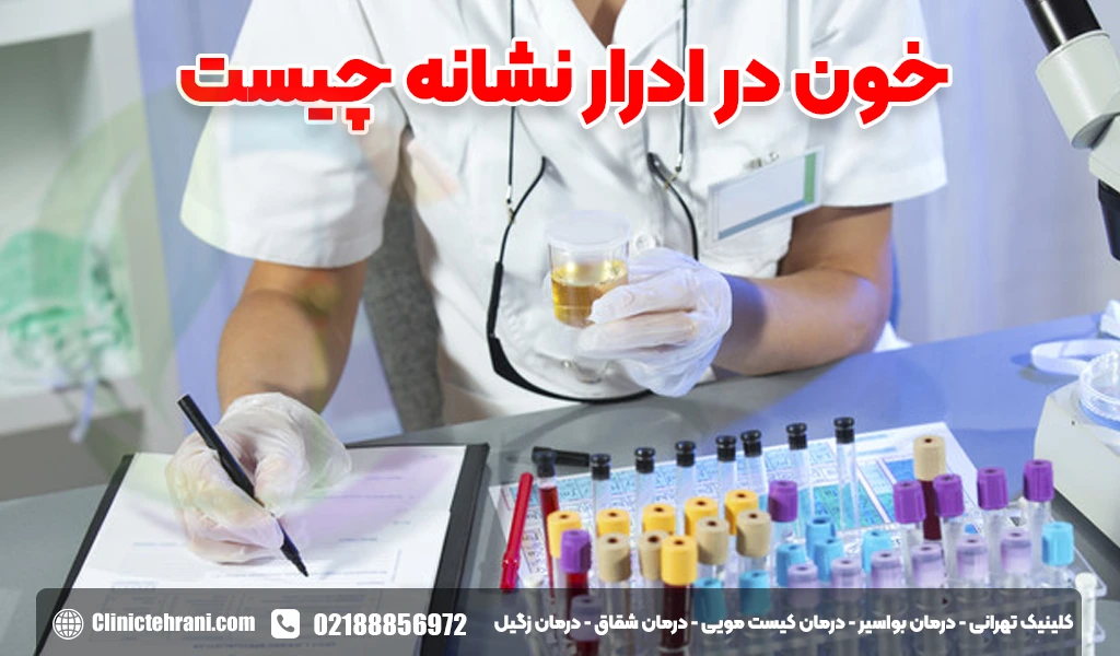 خون در ادرار نشانه چیست