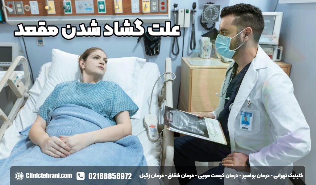 علت گشاد شدن مقعد