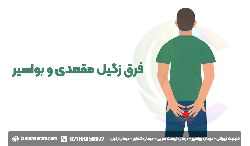 فرق زگیل مقعدی با بواسیر