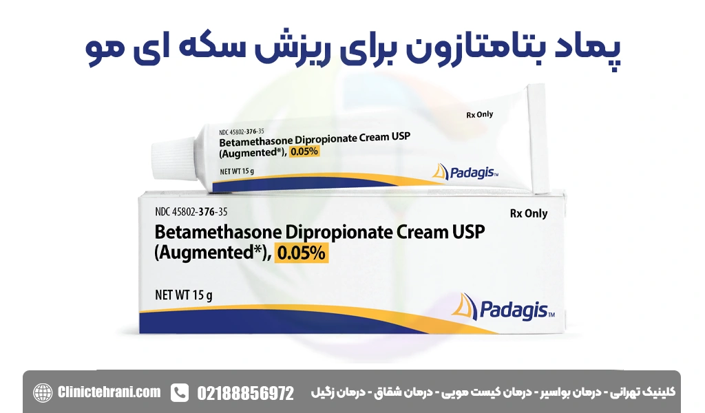 پماد-بتامتازون-برای-ریزش-سکه-ای-مو