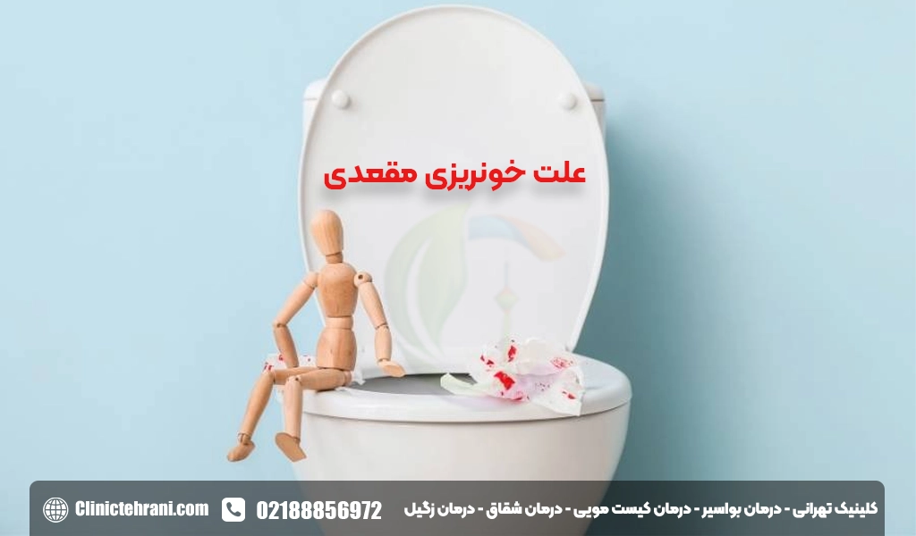 علت خونریزی مقعدی بدون درد در مردان