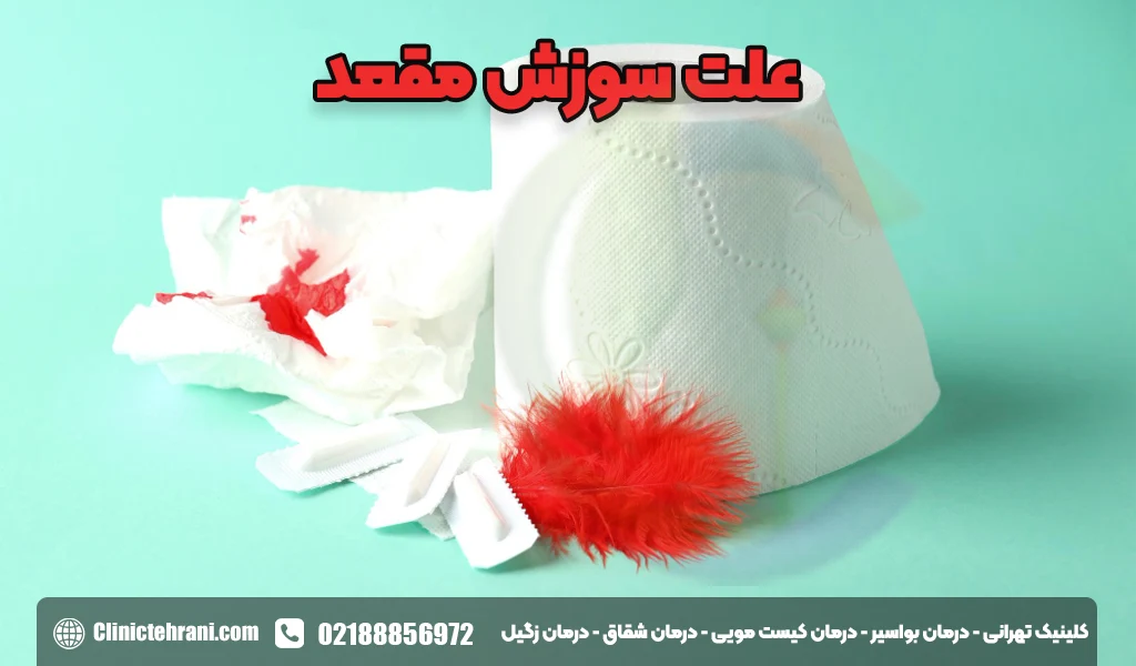 علت سوزش مقعد