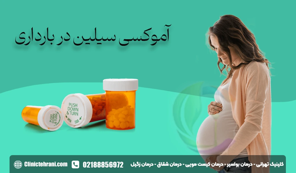 آموکسی سیلین در بارداری