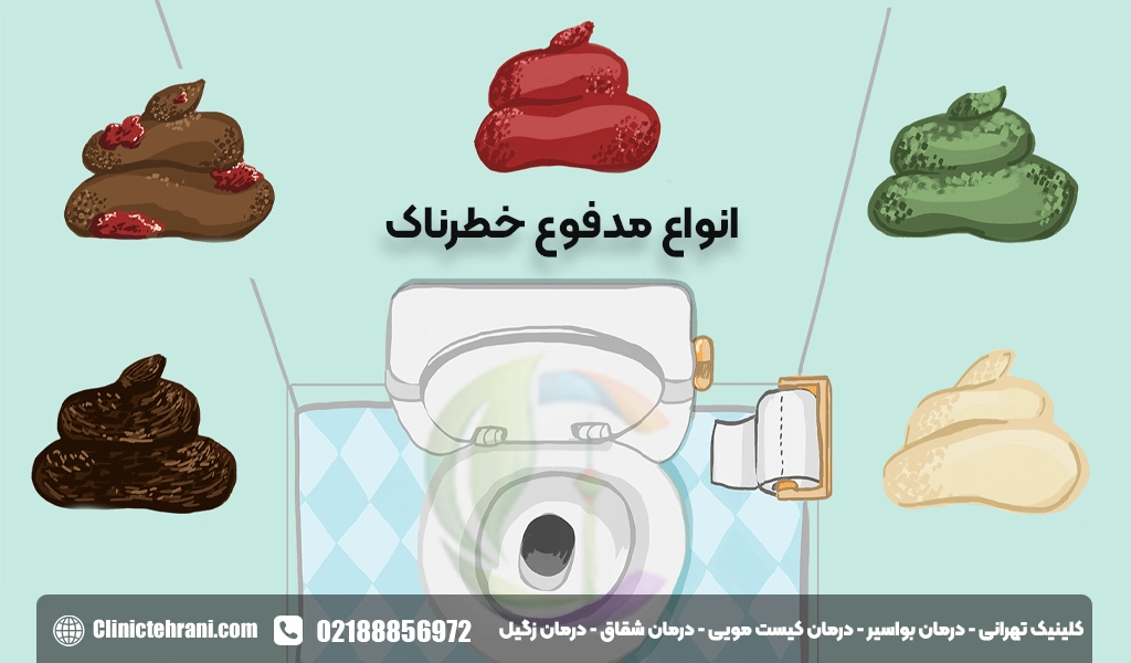 انواع مدفوع خطرناک
