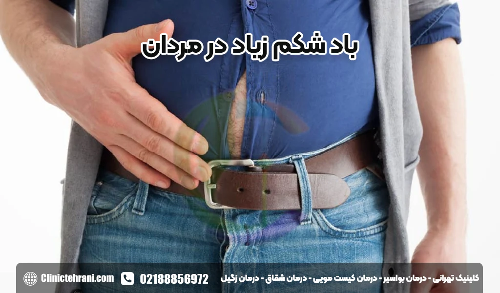 باد شکم زیاد در مردان