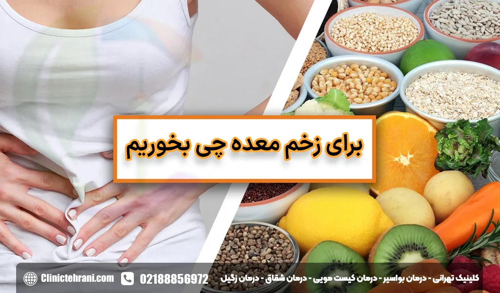 برای زخم معده چی بخوریم