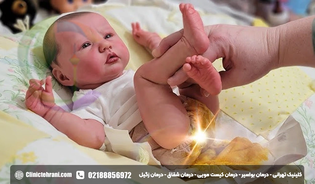 مدفوع نوزاد