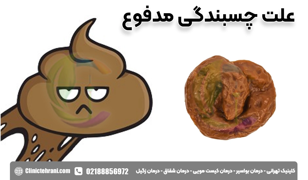 علت چسبندگی مدفوع