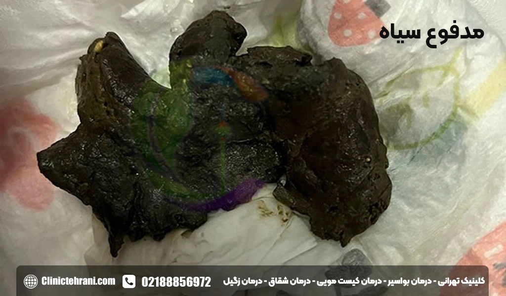 مدفوع سیاه