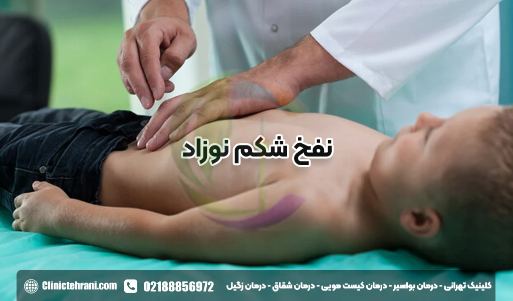 نفخ شکم نوزاد
