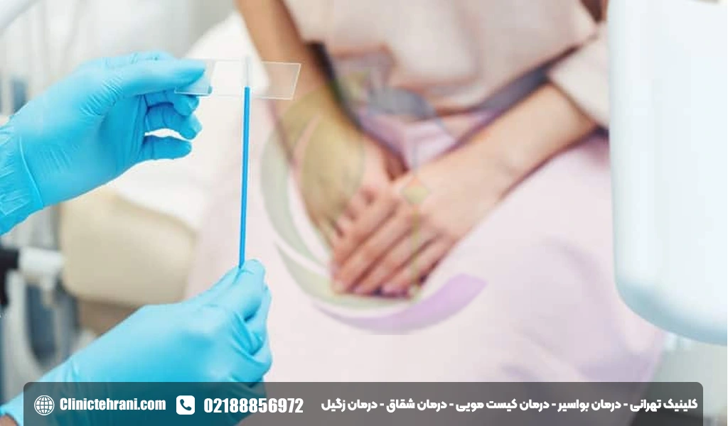 بهترین زمان برای تست پاپ اسمیر