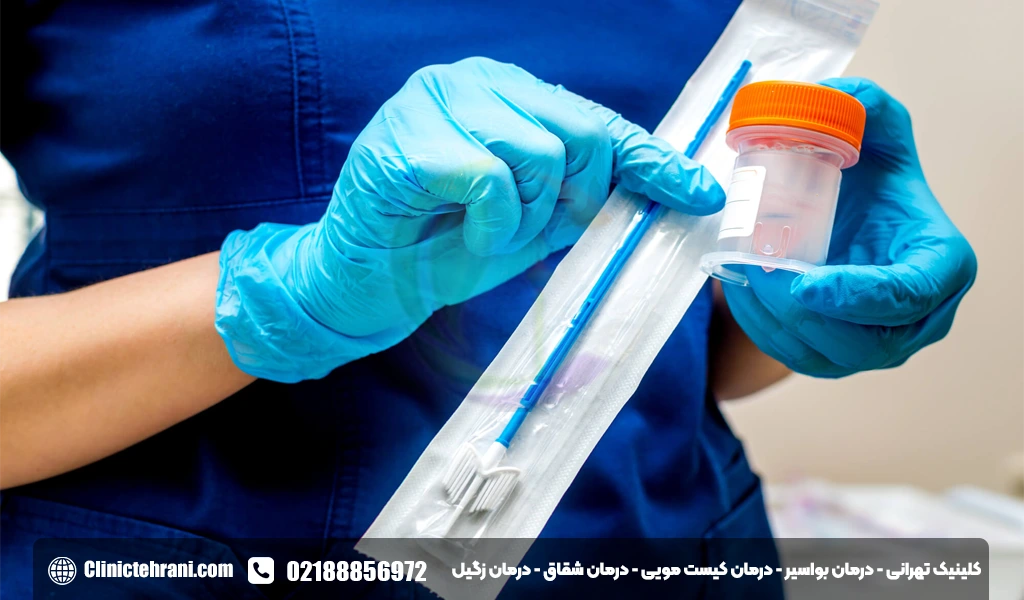 تست پاپ اسمیر