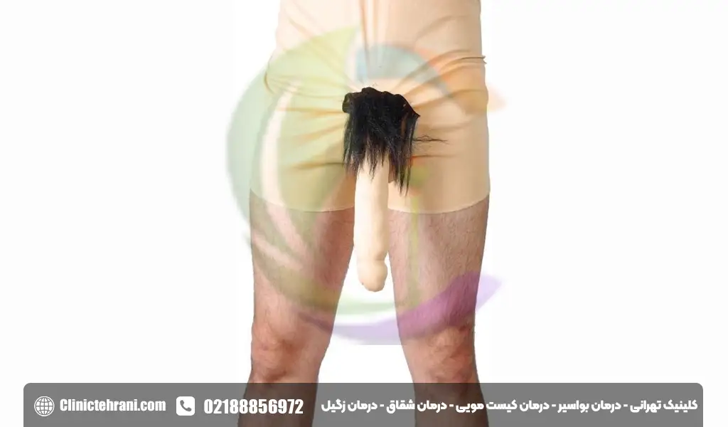 انواع آلت تناسلی مردان