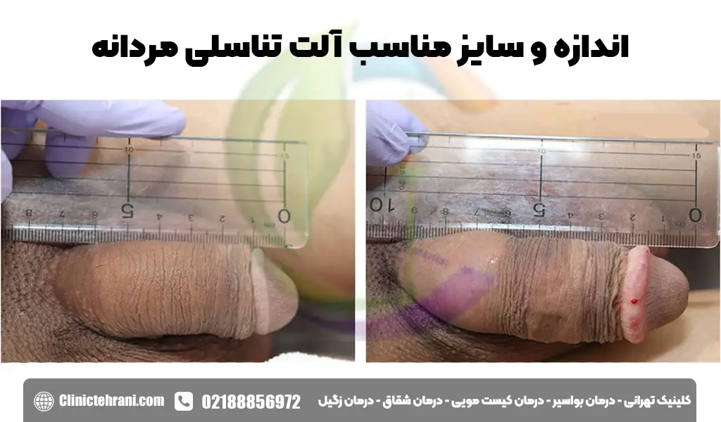 اندازه و سایز مناسب آلت تناسلی مردانه