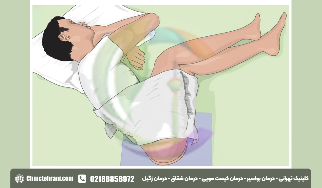 اماله