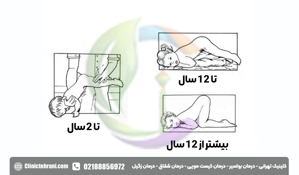 تنقیه