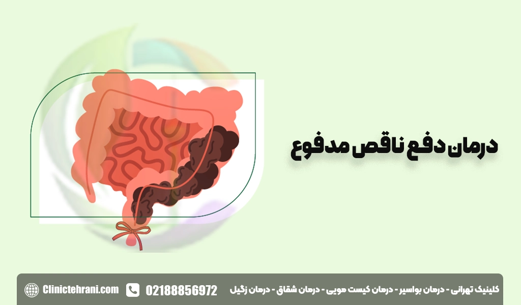 درمان دفع ناقص مدفوع