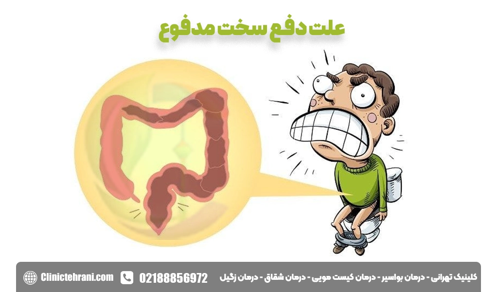علت دفع سخت مدفوع