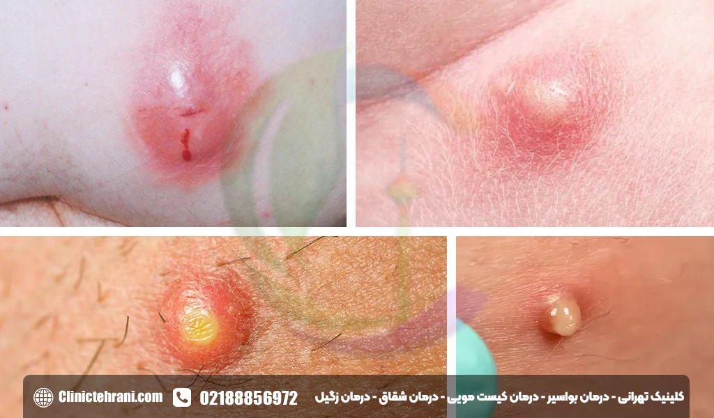 عکس جوش مقعدی