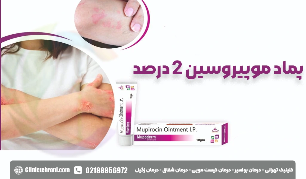 پماد موپیروسین 2 درصد