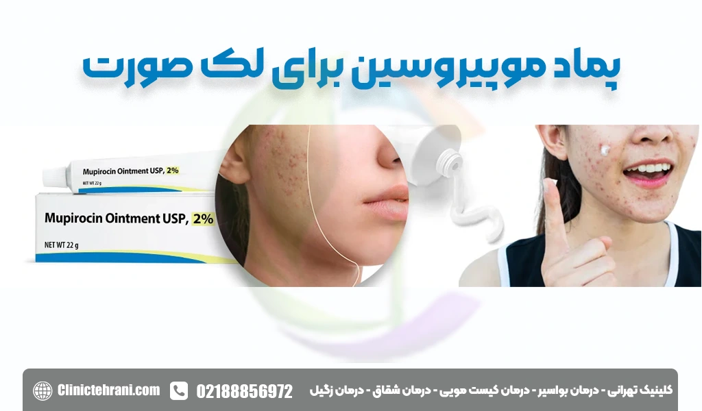 پماد موپیروسین برای لک صورت