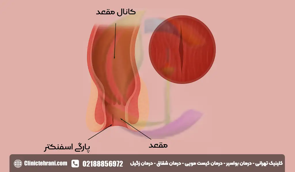 اسفنکتر مقعدی