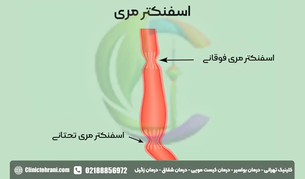 اسفنکتر مری