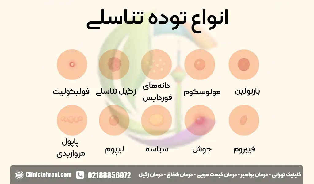 انواع توده تناسلی