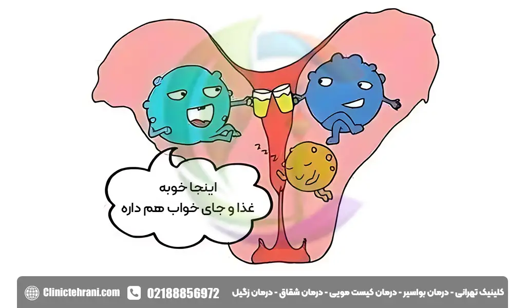 درمان توده سفت زیر پوست در ناحیه تناسلی