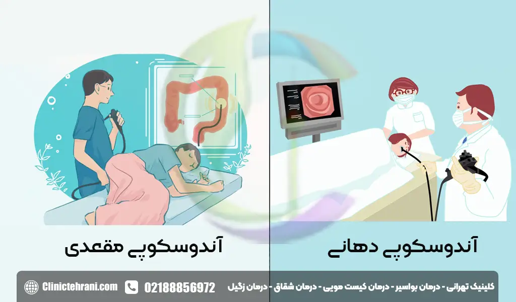آندوسکوپی از کجا انجام میشود