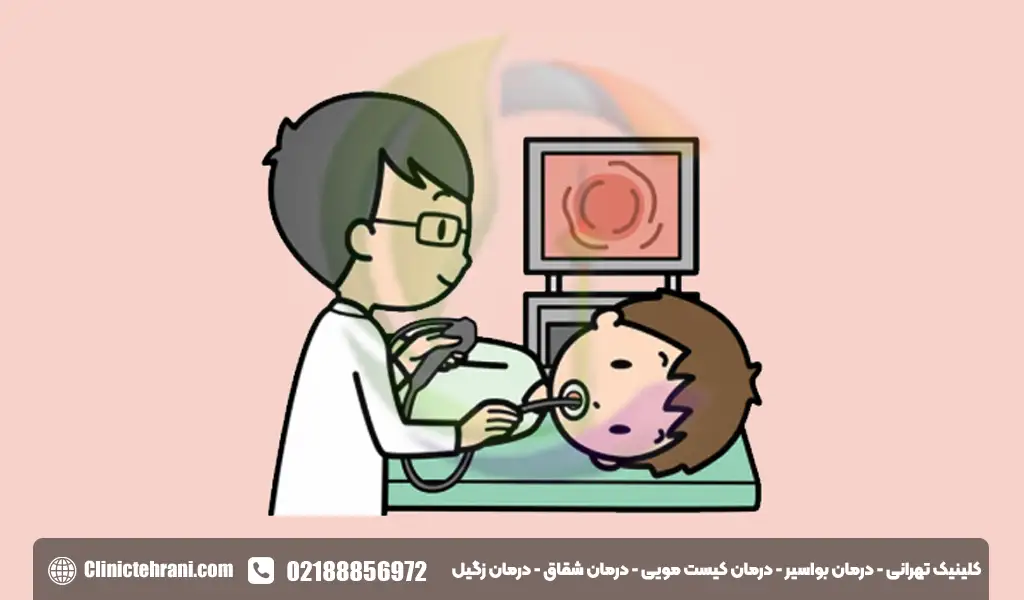 آندوسکوپی کبد