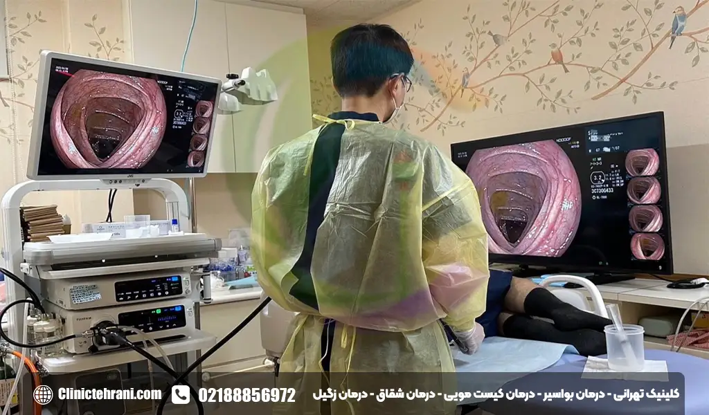 آندوسکوپی