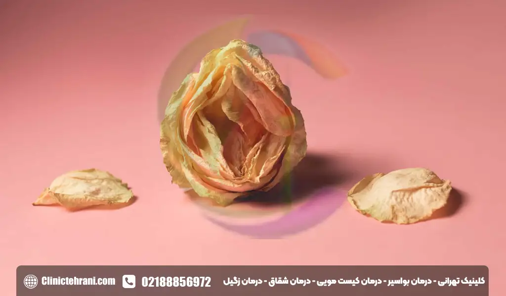 خشکی واژن