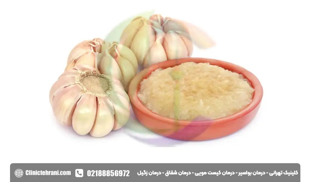 سیر برای درمان زگیل