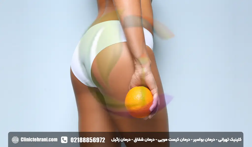 درمان خانگی زگیل