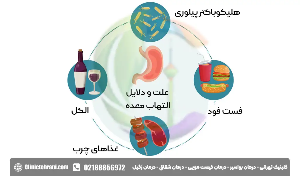 علت و دلایل التهاب معده