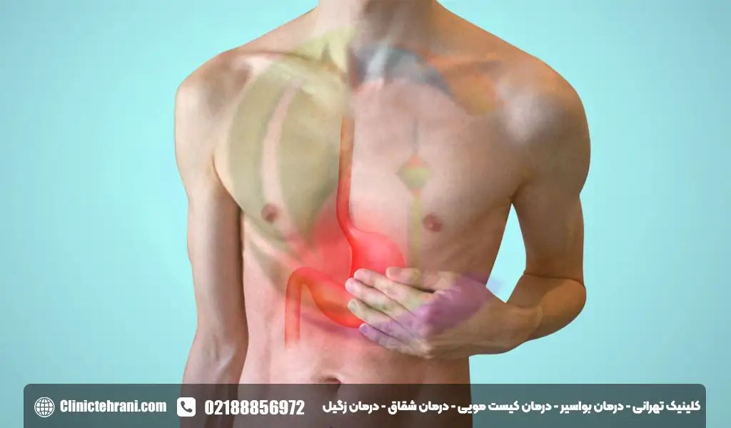 التهاب معده