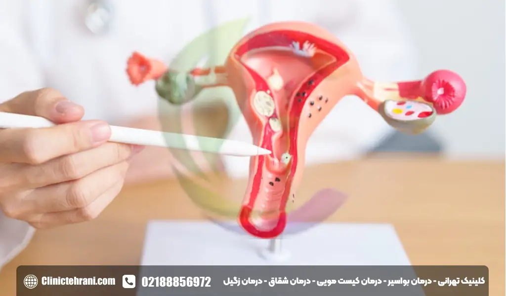 دهانه رحم کجاست