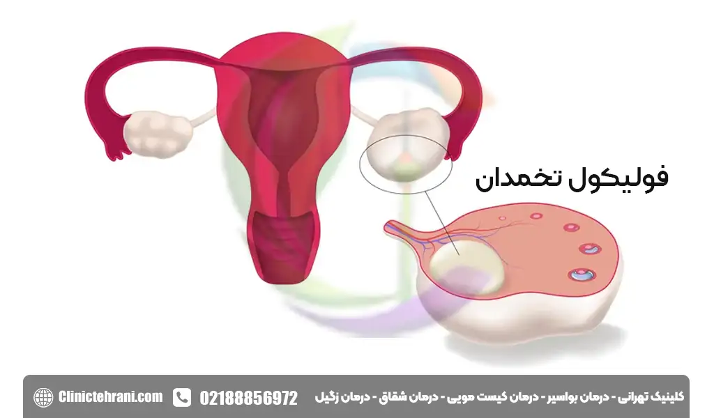 فولیکول تخمدان