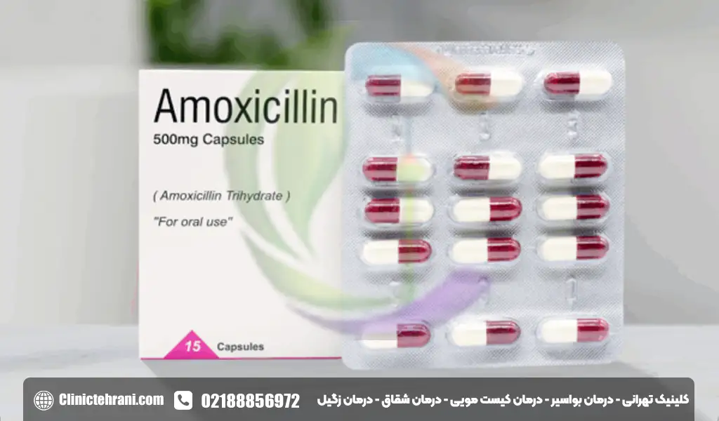 بهترین آنتی بیوتیک برای عفونت لثه