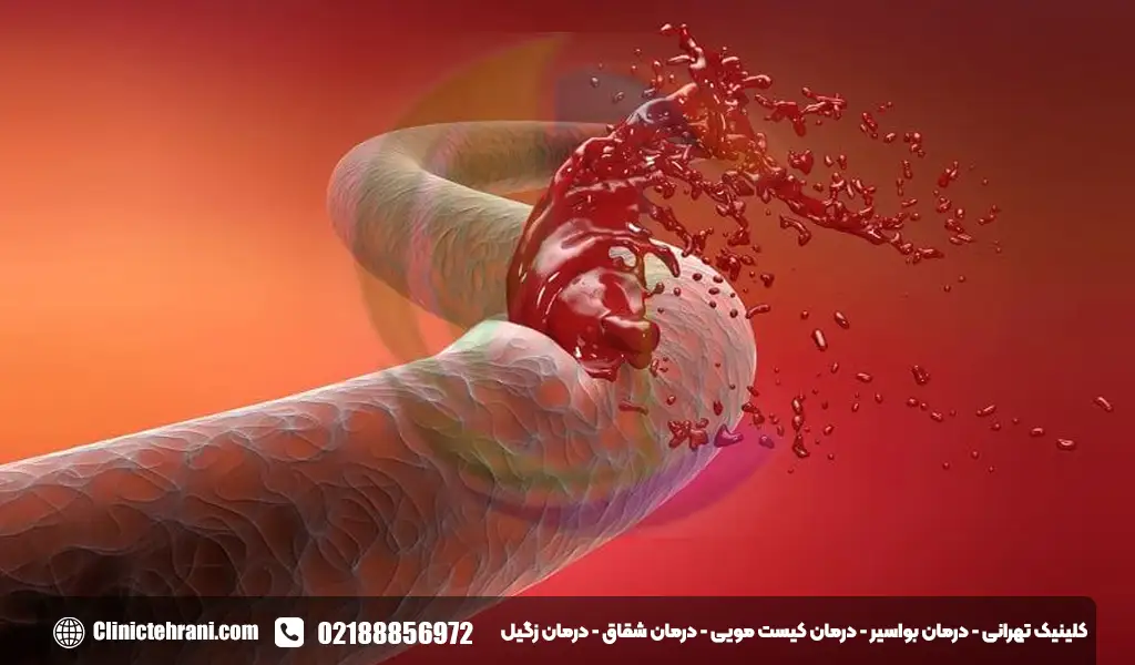 تداخلات دارویی آنتی بیوتیکها